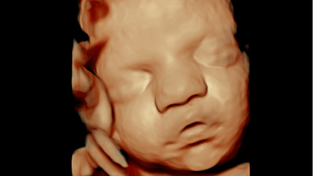 Ultrassom 3D: detalhes que encantam