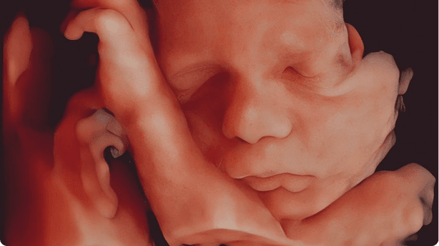 Ultrassom 4D: o bebê em movimento, em tempo real